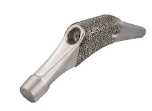 Alteon® Tapered Wedge Femoral Stem - Exactech
